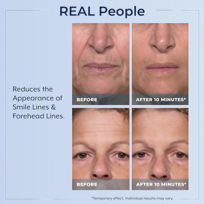 Rapid Reduction Serum -1-Month Supply