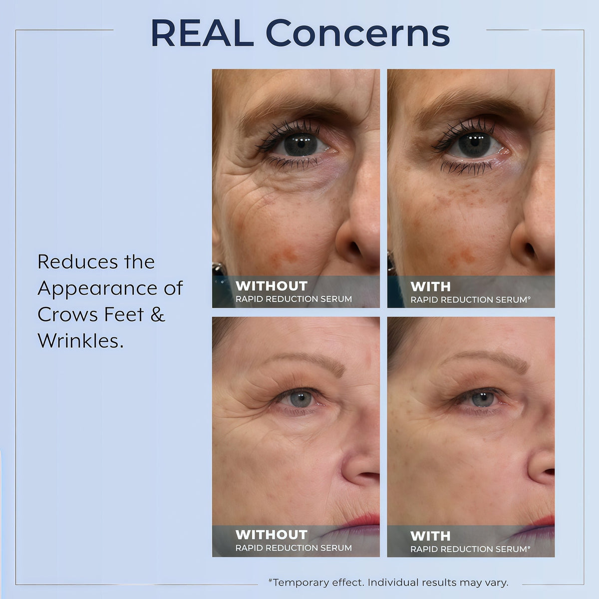 Rapid Reduction Serum -1-Month Supply