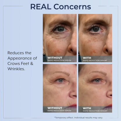 Rapid Reduction Serum -1-Month Supply