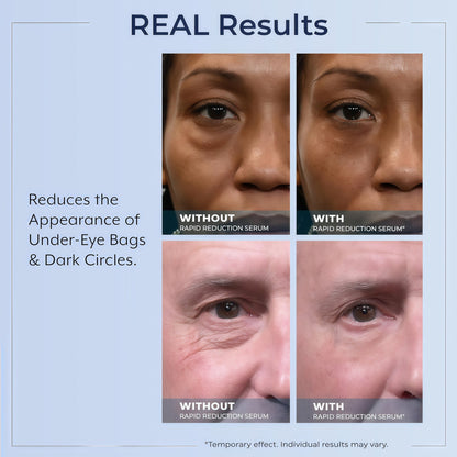 Rapid Reduction Serum -1-Month Supply